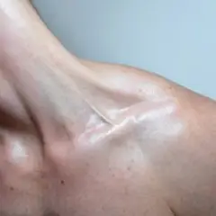 Slipping (Mixed)